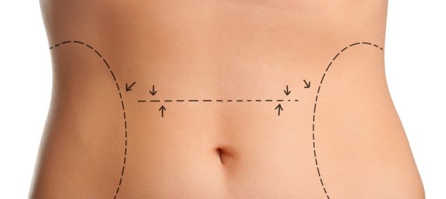 São Paulo realiza 50 mil cirurgias plásticas mensalmente
