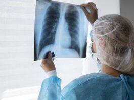 Foto: Freepik RENAN ALEXANDRINI Da Redação* A semana é marcada por uma série de ações dos municípios do ABC contra a tuberculose. Causada por uma bactéria que atinge principalmente os pulmões, a doença contamina 70 mil pessoas no Brasil e gera, em média, 4,5 mil mortes todos os anos. Foi pensando nisso que, em 2017, o Ministério da Saúde criou o plano nacional Brasil Livre da Tuberculose, cujo objetivo é, até 2035, reduzir 90% o