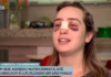 Suspeito de quebrar nariz de nutricionista é localizado e diz que vídeo da agressão é montagem