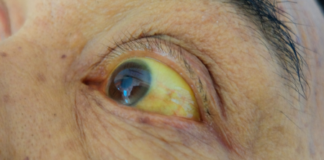 Estado de SP alerta sobre a importância da vacinação contra a febre amarela