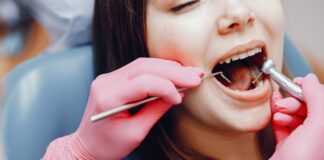 Cárie inicial: entenda quando começa e como identificar