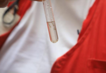 Mauá realiza uma série de ações preventivas contra dengue