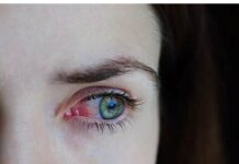 Gripe e resfriado aumentam casos de conjuntivite