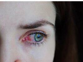 Gripe e resfriado aumentam casos de conjuntivite